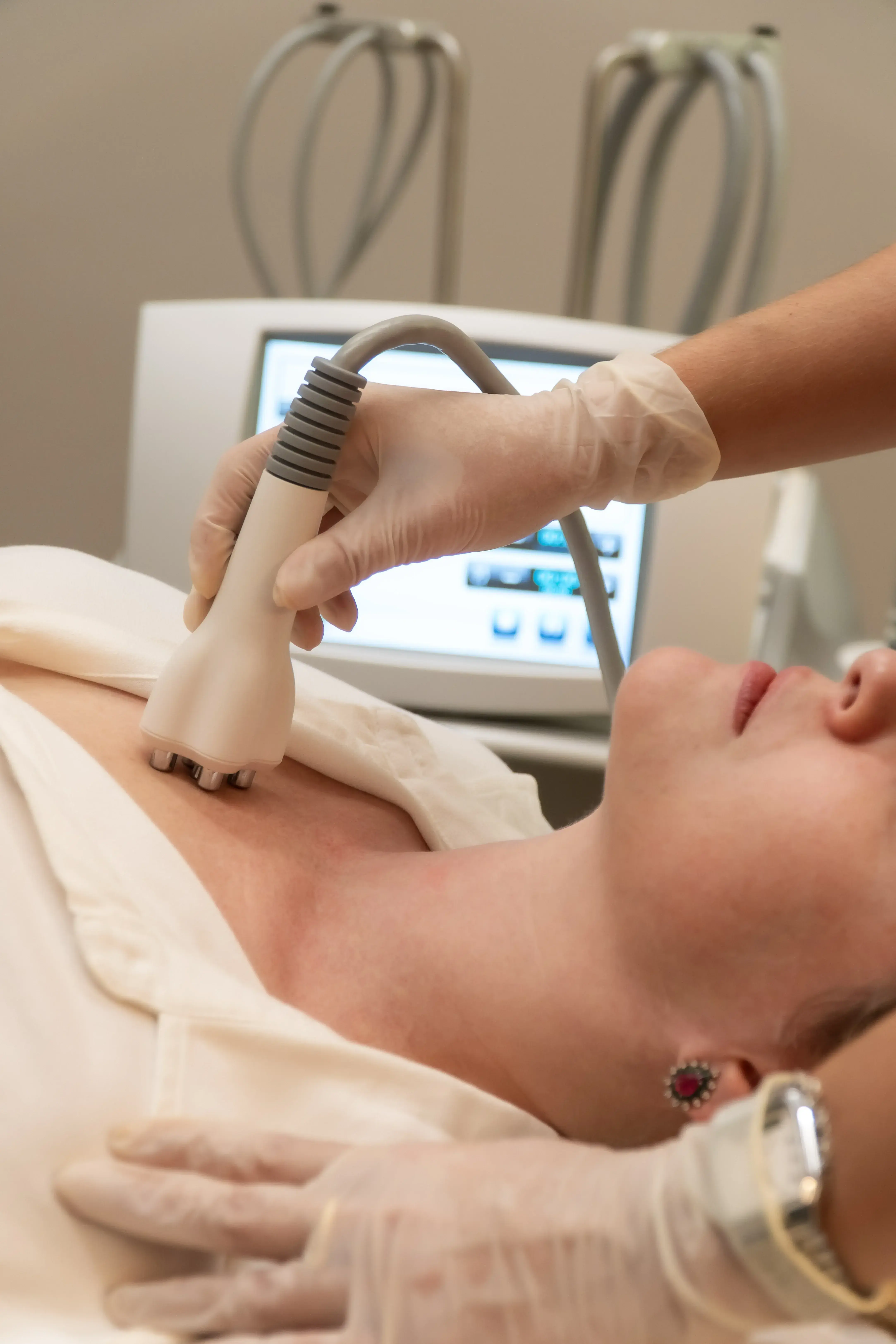 Tratamento para Colo - Tratamento dermatológico para rejuvenescimento do colo: rugas, flacidez e alterações na região do decote.